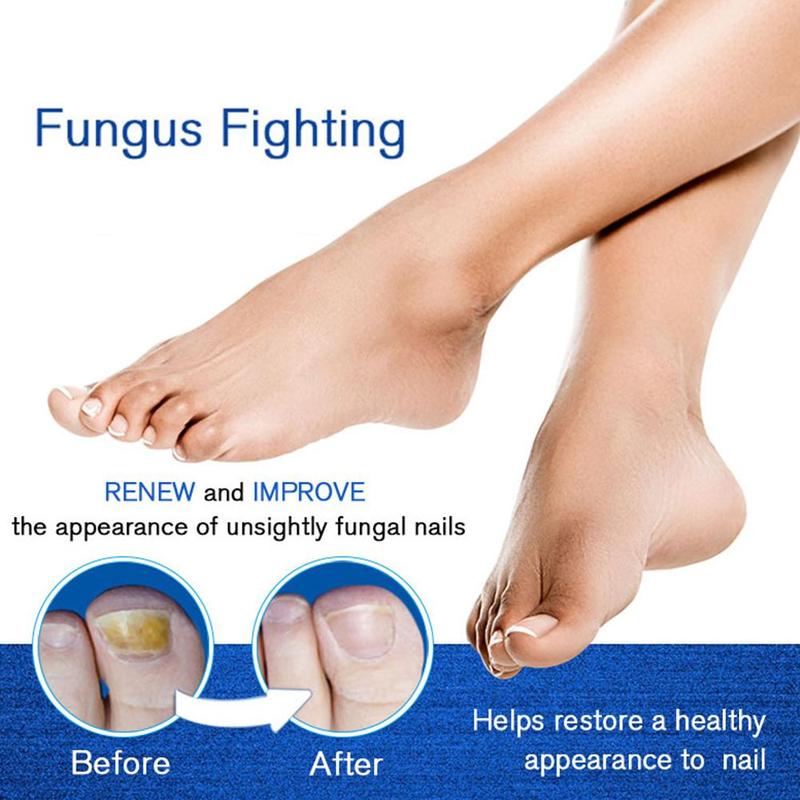 4ml Nail Repair Treatment Liquid Fungus Remover Protective Brush Nail Hand Pen Nourishing Foot Brightening Nail Care S6J8