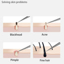Acne Blackhead Removal Needles Stainless Steel Black Spot Blemish Pimple Removal Needle Deep Cleansing Tool Face Skin Care Kit