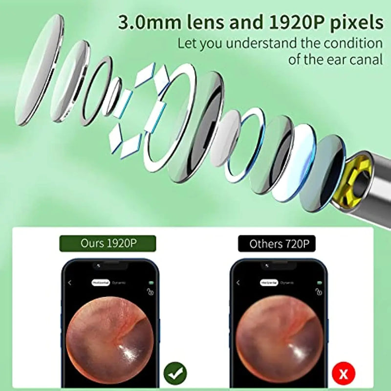 Ear Wax Removal Tool, 1920P HD Ear Cleaner with 6 LED Lights, 3mm Mini Visual Ear Camera for iPhone, iPad, Android